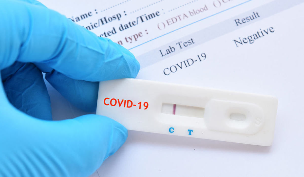 Rapid Antigen Test